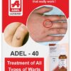 ADEL 40 - Warts Drops