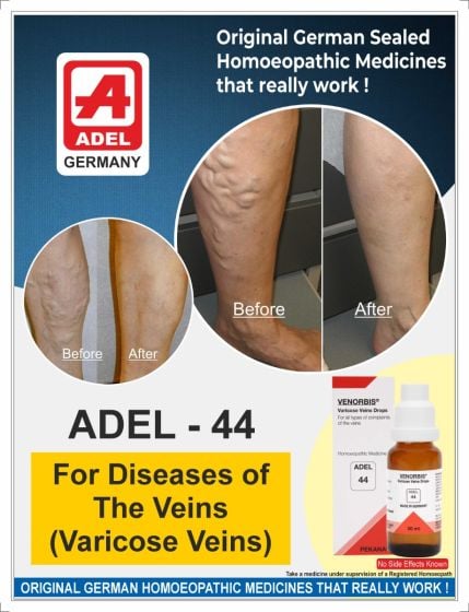 ADEL 44 - Varicose Veins Drops