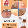 ADEL 86 - Warts (External)