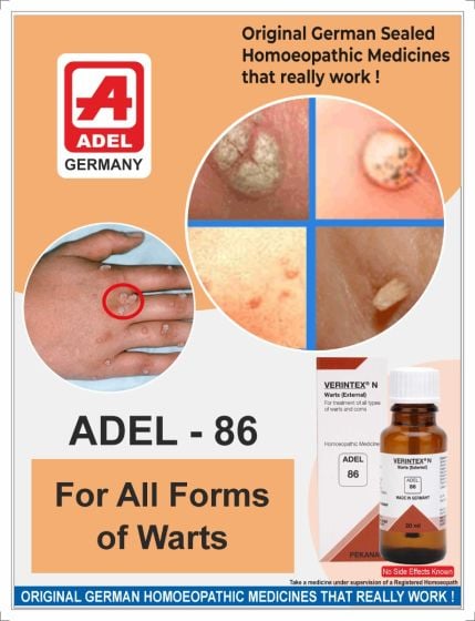 ADEL 86 - Warts (External)